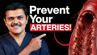 Vascular Surgeon: THIS Happens to Your Arteries 10 Minutes After Every Meal