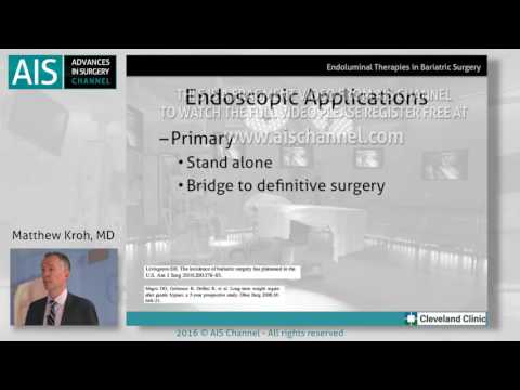 Endoluminal Therapies in Bariatric Surgery by Matthew Kroh