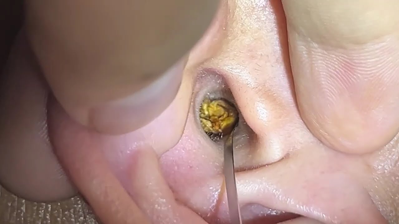 🎯極上の耳掃除 💫眠れない夜に効く耳かきASMR FG2551