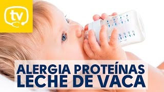 La alergia a las proteínas de la leche de vaca en bebés