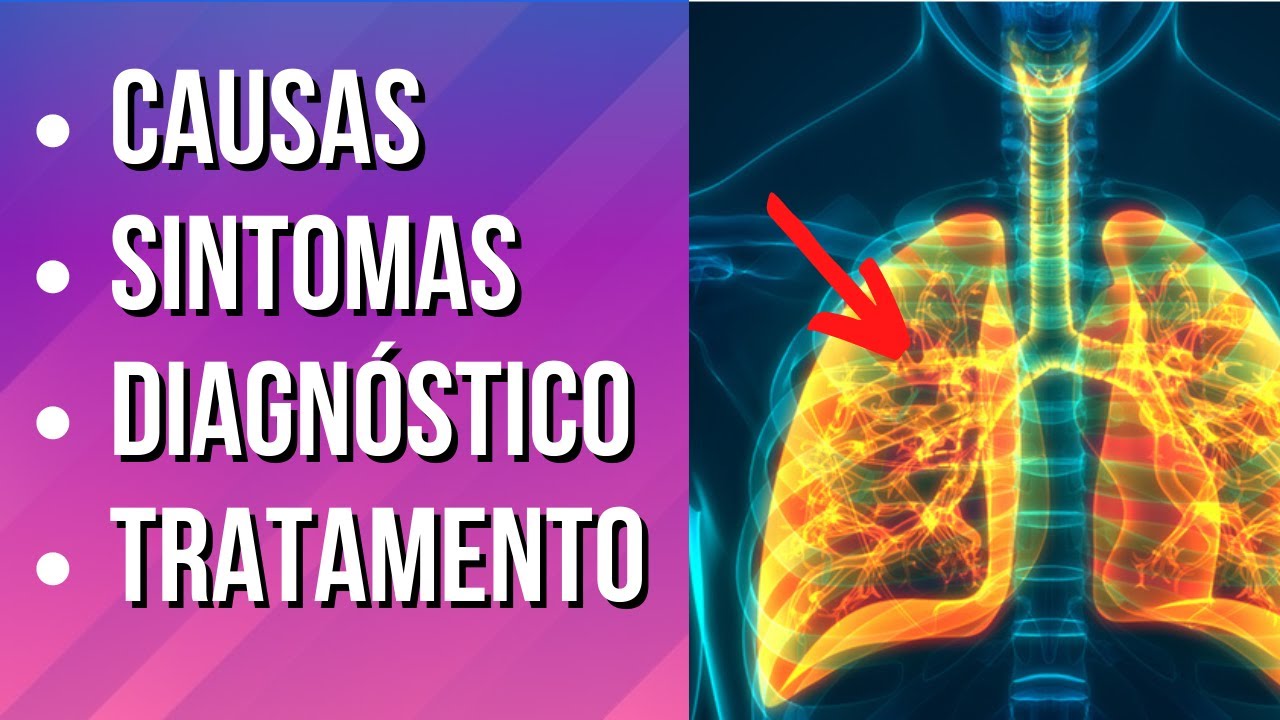 INSUFICIÊNCIA RESPIRATÓRIA - Causas, Sintomas e Tratamento