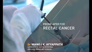 Laparoscopic Prone Abdomino Perineal Resection for Rectal Cancer