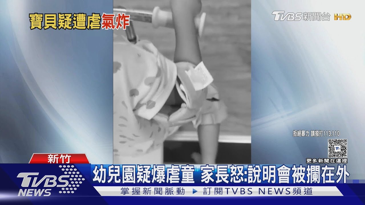 幼兒園疑爆虐童!控孩遭打巴掌 家長說明會被攔 教育處:調查中