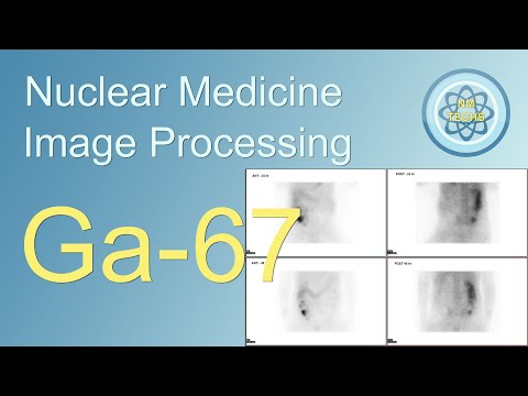 Ga-67 image Processing, in nuclear medicine