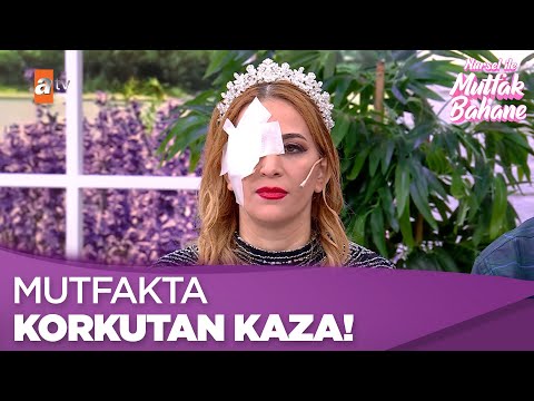 Nazlı mutfakta ciddi bir kaza atlattı! - Nursel ile Mutfak Bahane 23 Nisan 2025