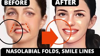 🛑 FACE LIFTING EXERCISES FOR NASOLABIAL FOLDS | SAGGY SKIN, JOWLS, FOREHEAD LINES, MOUTH, JAWLINE