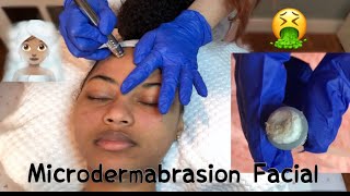 FIRST TIME GETTING A MICRODERMABRASION FACIAL AND LIP SCRUB