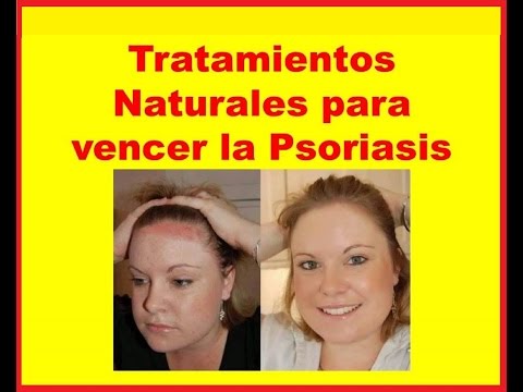 La foto podostroy las eccemas Psoriaznye blyashki sobre el miembro