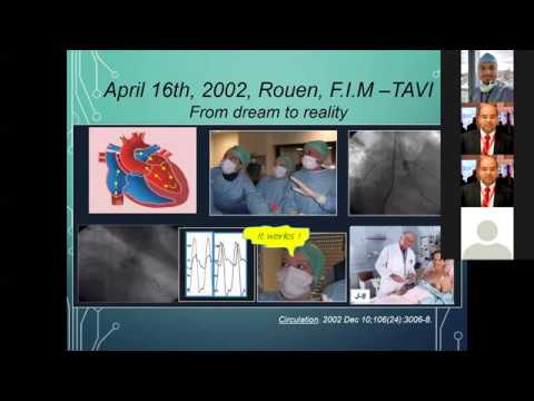 TAVI lecture 1 Webinar Introduction and overview    By Dr Reda Abu Elatta