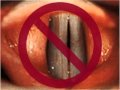 #14 - Artificial larynx vs. text to speech: you decide