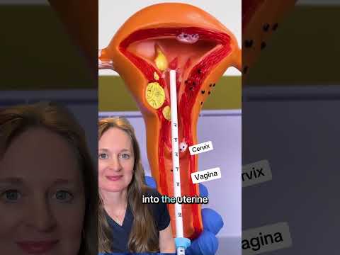 Did you learn something? #iud