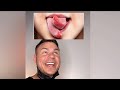 Orthodontist Reacts! How Does His Tongue Do THIS?! #Shorts