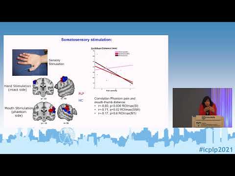 ICPLP2021 - Prof. Flor: Phantom limb pain: a dynamic network perspective