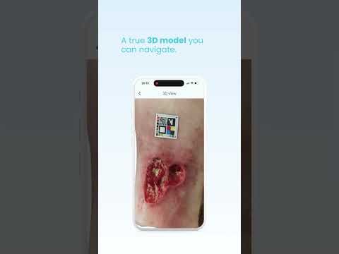 TwinSkin video thumbnail