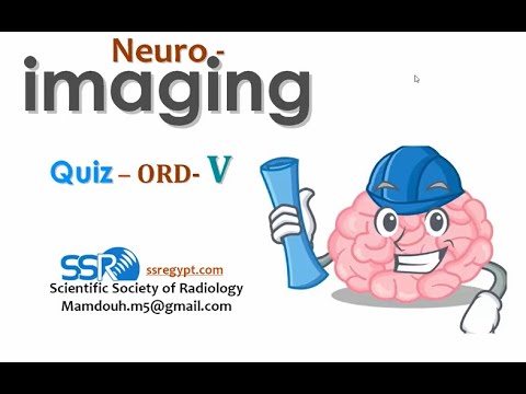 Brain imaging quiz cases (6) - Prof  Mamdouh Mahfouz