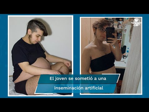 Rubén Castro hace historia al convertirse en el primer hombre trans en dar a luz en España