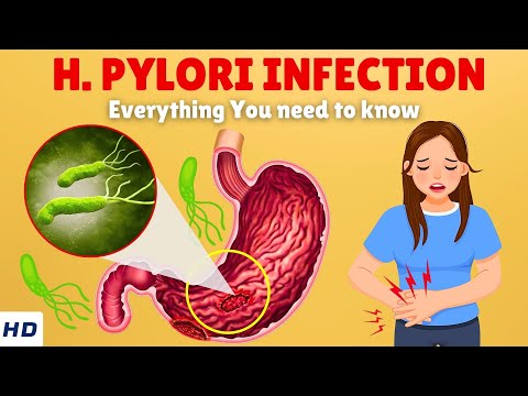 Helicobacter Pylori Infection – Causes, Signs and Symptoms, Diagnosis & Treatment