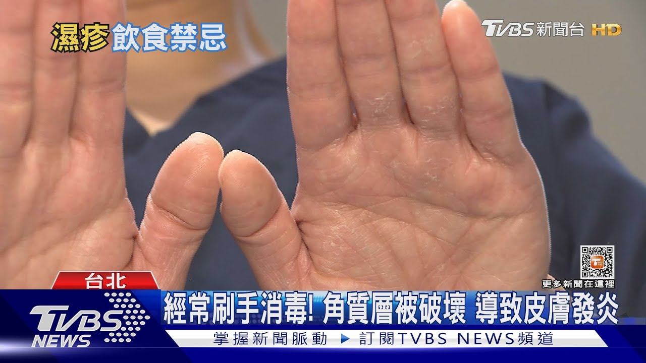 不注意「這幾件事」下場慘! 醫師:悶熱潮濕易誘發「這疾病」