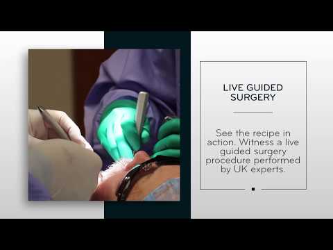 The Cooking Recipe for Guided Surgery: Single Implant to Full Arch