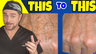 Erase Skin Aging In Minutes With This! | Chris Gibson