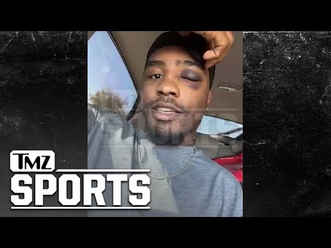 MMA Fighter Mark Martin Hoping To Make Comeback After Eye Popped Out During Fight | TMZ Sports