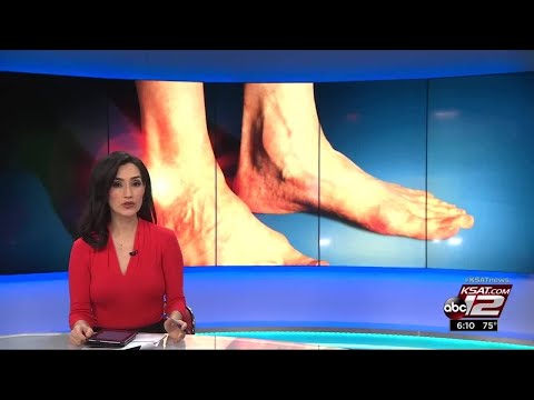 VIDEO: Is total replacement the cure for treating ankle arthritis?