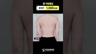 “팔 라인 뭐야… 달라진 거 실화?” ✨