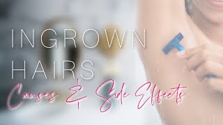 HOW TO GET RID OF INGROWN HAIRS FAST - (MUST WATCH)