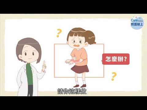 夢見燙傷手