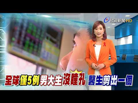 男大生先天沒瞳孔 醫生「剪」一個開光