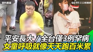 全台僅3例的罕病　女童呼吸像天天跑百米累