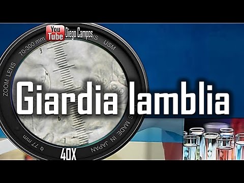 Quello che definisce vermi in sangue Come trattare un nastro strisciano a gatti