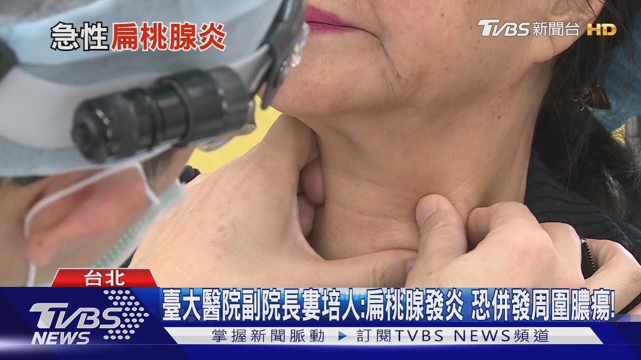 這種病周圍膿瘍「易吞嚥困難、喉嚨痛」　免疫力差的人有致死風險！