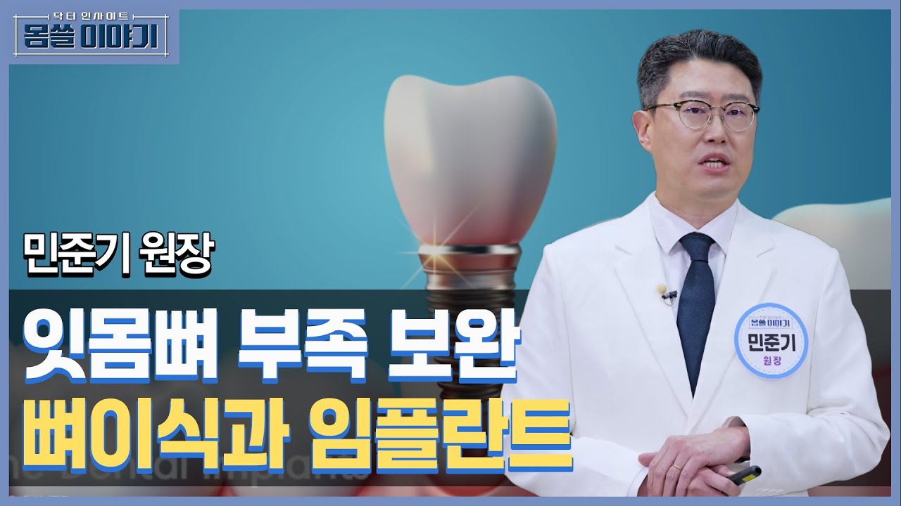 뼈가 부족해서 안되는 수술은 이제 그만! 임플란트 이제는 가능합니다 [몸쓸이야기 7회]