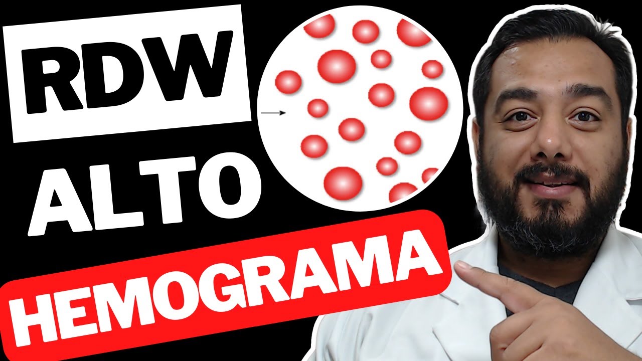 RDW Alto no Exame de Sangue | Hemograma | Eritrograma | Índices Hematimétricos | Anisocitose