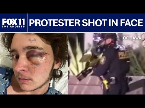 Renee Good protester shot in face by federal officer in Santa Ana | FOX 11 LA