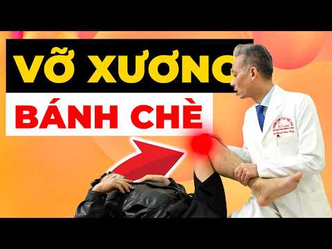 Sau 4 Tháng Vỡ Xương Bánh Chè Đau – Sai Lầm Khiến Không Gập Gối Bình Thường