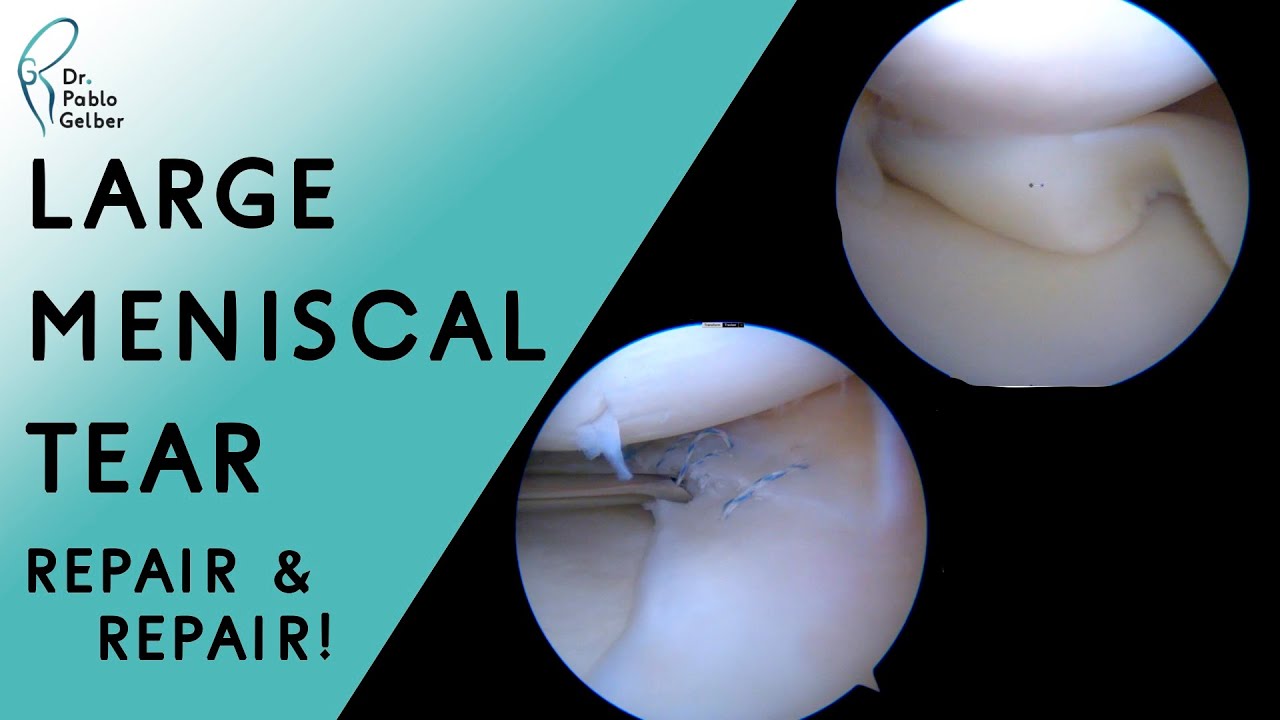 Pablo E. Gelber Ghertner-15