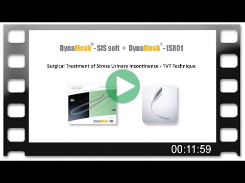 DynaMesh®-SIS soft+DynaMesh®-ISR01 - OR-Video: Surgical Treatment of Stress UI - TVT Technique (en)