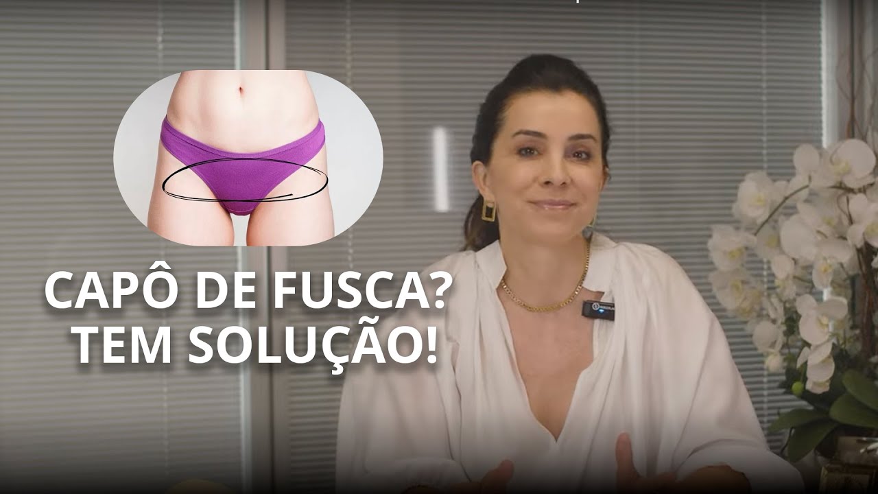 COMO DIMINUIR O VOLUME DO PÚBIS (FAMOSO CAPÔ DE FUSCA)