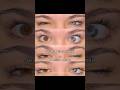 Types Of Heterochromia Eyes You May Have🩶 Shorts Glowup