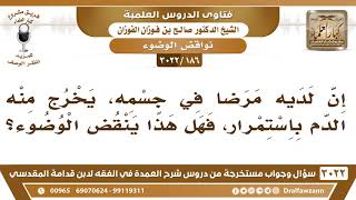 صورة [186 -3022] لديه مرض في جسمه، يخرج منه الدم باستمرار، فهل ينتقض عليه الوضوء؟ - الشيخ صالح الفوزان