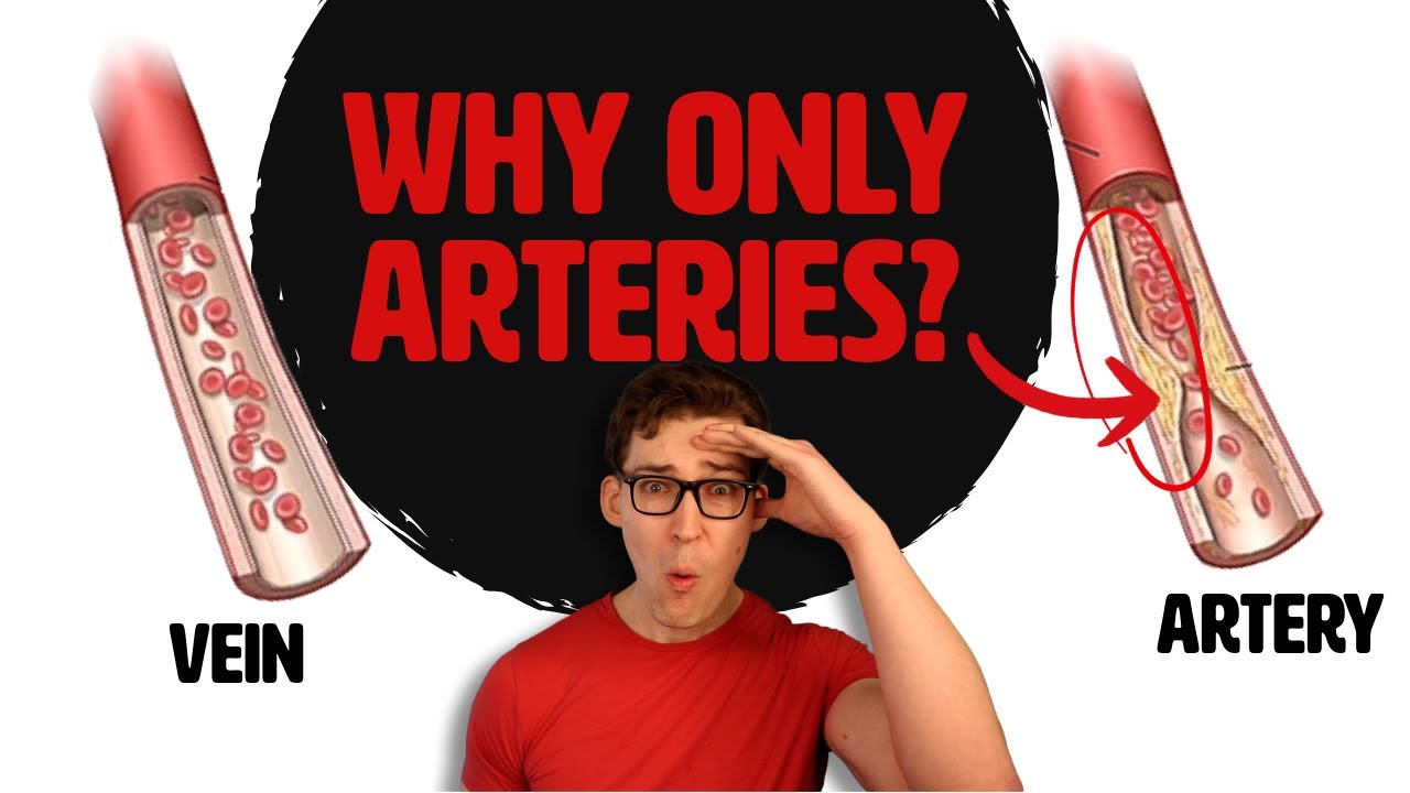 Why do we develop plaque in our arteries, but not our veins?