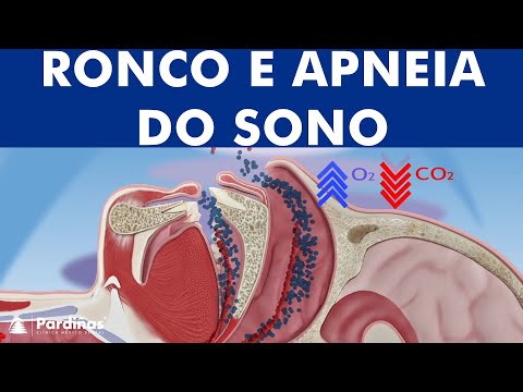 Ronco apneia do sono ©
