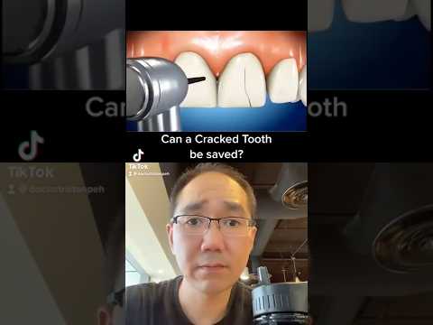What can be done if you have Cracked tooth? 😱