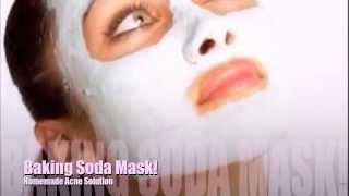 Baking Soda Mask! (Helps with acne)