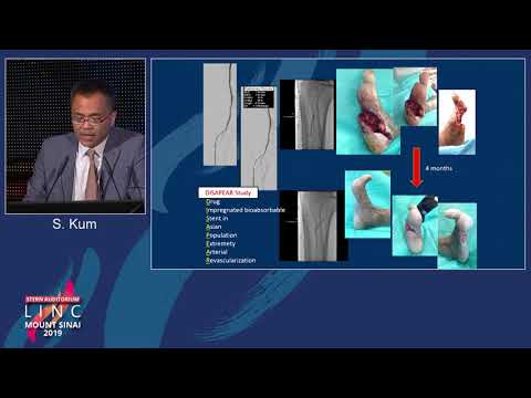 Stern D2 - Bioabsorbable Vascular Scaffold (BVS) for CLI; DISAPEAR Registry - Dr. Steven Kum