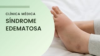 Síndrome Edematosa