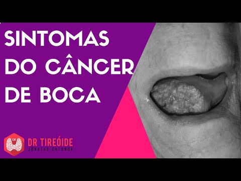 Mucinous colorectal cancer