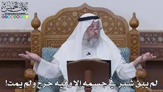 1583 - لم يبقَ شبر في جسمه إلا وفيه جرح ولم يمت! - عثمان الخميس